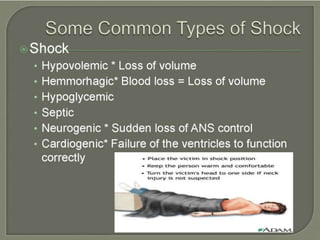 trauma.pptx