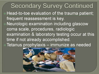 trauma.pptx