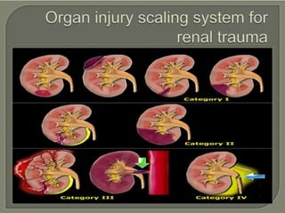 trauma.pptx