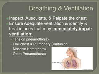 trauma.pptx