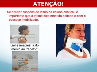 Se houver suspeita de lesão na coluna cervical, é
importante que a vítima seja mantida deitada e com o
pescoço imobilizado.
ATENÇÃO!
Linha imaginária do
mento ao trapézio
 