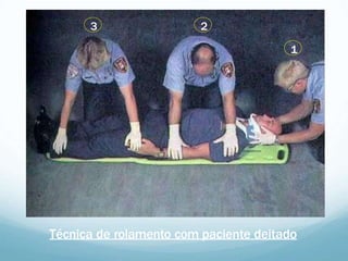 Técnica de rolamento com paciente deitado
3 2
1
 