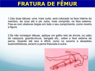 1.Use duas tábuas: uma, mais curta, será colocada na face interna do
membro, da coxa até o pé; outra, mais comprida, na face externa.
Fixe-as com ataduras largas em todo o seu comprimento, como mostra
a figura.
2.Se não conseguir tábuas, aplique um galho reto de árvore, ou cabo
de vassoura, guarda-chuva, bengala etc., sobre a face externa da
perna. Quando até isso é difícil, como no socorro a desastres
automobilísticos, amarre a perna fraturada à outra.
FRATURA DE FÊMUR
 