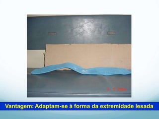 Vantagem: Adaptam-se à forma da extremidade lesada
 