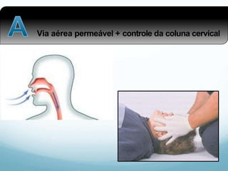 Via aérea permeável + controle da coluna cervical
 