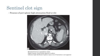 Liver splenic and renal trauma presentation for postgraduates in ...