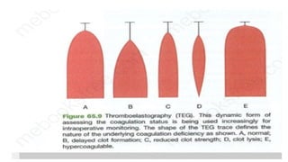 Dcapblstic trauma ABDOMEN,CHEST AND NEUROTRAUMA.pptx