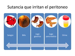 Sutancia que irritan el peritoneo
Sangre Bilis
Jugo
gastrico
Jugo
pancreatico
Orina
 