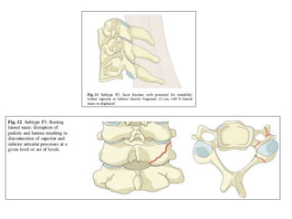 cervical Trauma classification | PPTX