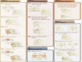 cervical Trauma classification | PPTX