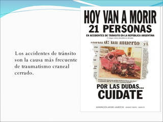 Los accidentes de tránsito son la causa más frecuente de traumatismo craneal cerrado.  