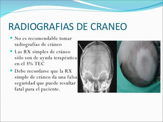 RADIOGRAFIAS DE CRANEO No es recomendable tomar radiografías de cráneo Las RX simples de cráneo sólo son de ayuda terapéutica en el 3% TEC Debe recordarse que la RX simple de cráneo da una falsa seguridad que puede resultar fatal para el paciente.  