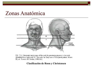 Zonas Anatómica
Clasificación de Roon y Christensen
 