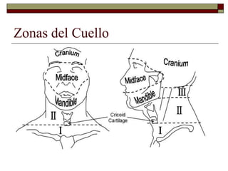 Zonas del Cuello
 