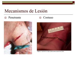 Mecanismos de Lesión
 Penetrante  Contuso
 