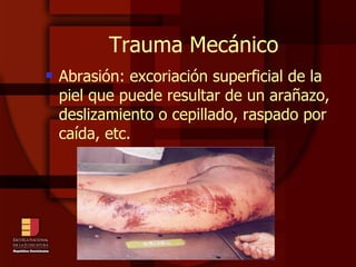 Trauma Mecánico Abrasión: excoriación superficial de la piel que puede resultar de un arañazo, deslizamiento o cepillado, raspado por caída, etc. 