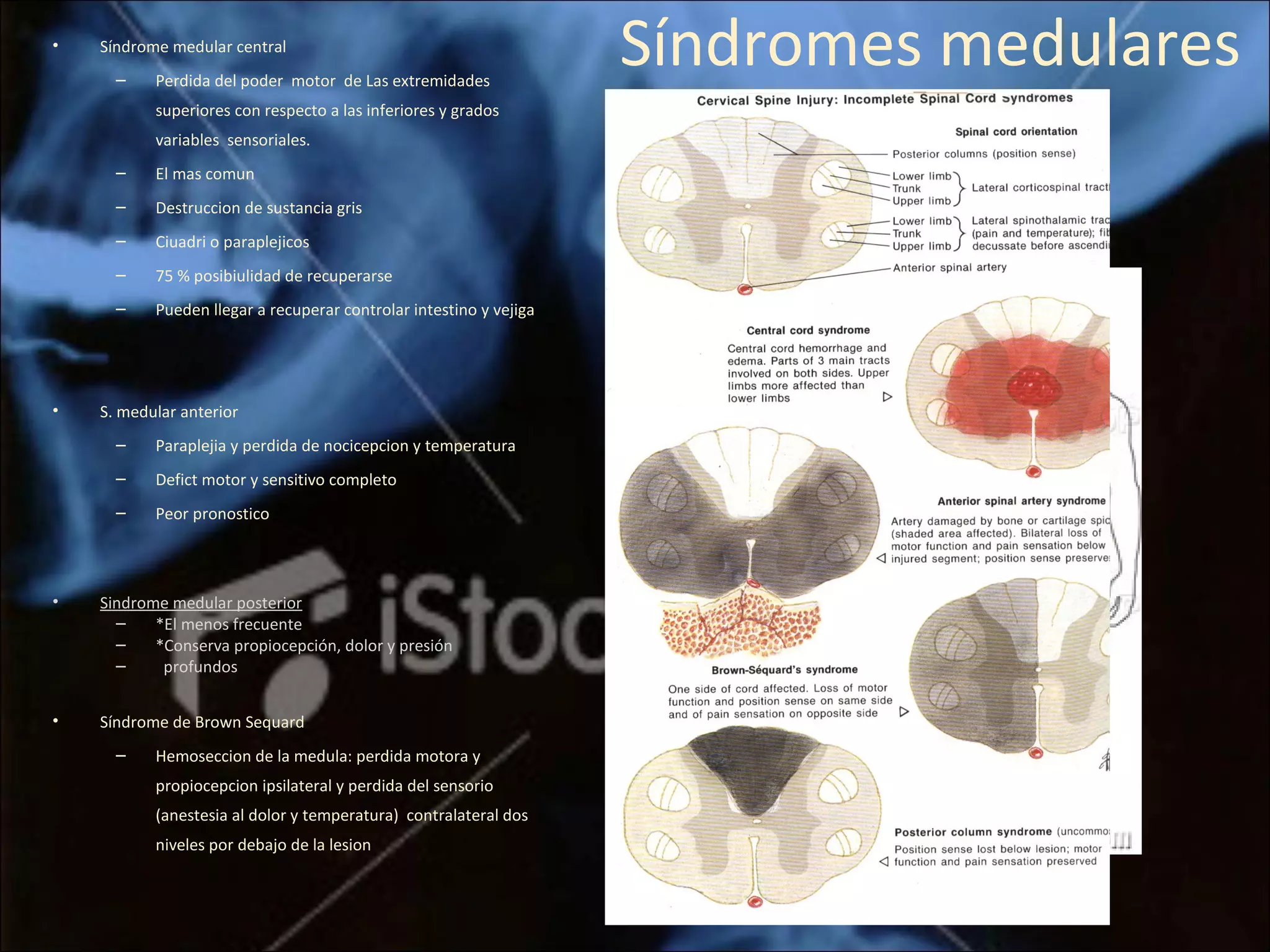 Trauma Medular | PPT