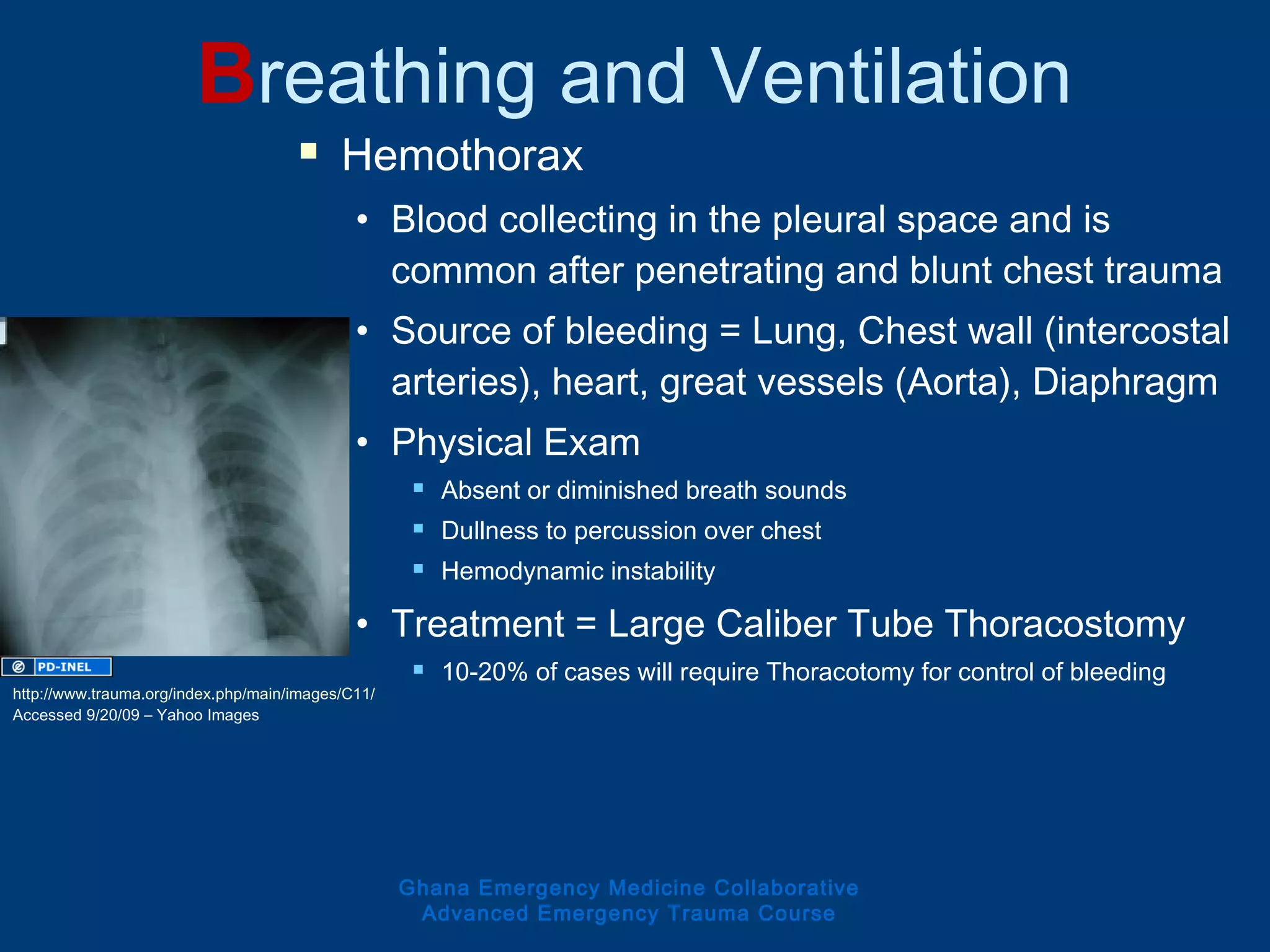  Hemothorax
• Blood collecting in the pleural space and is
common after penetrating and blunt chest trauma
• Source of bleeding = Lung, Chest wall (intercostal
arteries), heart, great vessels (Aorta), Diaphragm
• Physical Exam
 Absent or diminished breath sounds
 Dullness to percussion over chest
 Hemodynamic instability
• Treatment = Large Caliber Tube Thoracostomy
 10-20% of cases will require Thoracotomy for control of bleeding
Breathing and Ventilation
Ghana Emergency Medicine Collaborative
Advanced Emergency Trauma Course
http://www.trauma.org/index.php/main/images/C11/
Accessed 9/20/09 – Yahoo Images
 