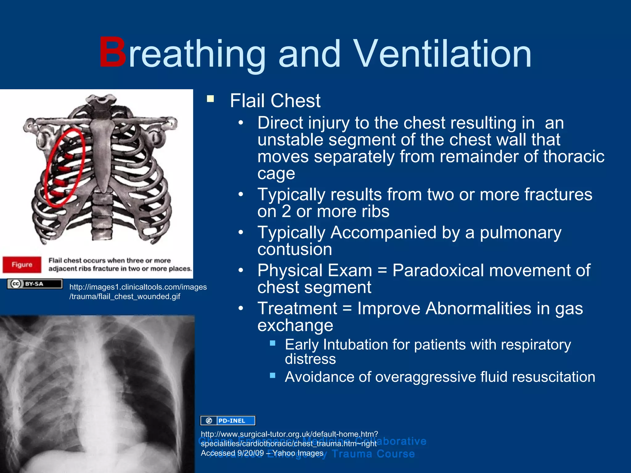 Breathing and Ventilation
 Flail Chest
• Direct injury to the chest resulting in an
unstable segment of the chest wall that
moves separately from remainder of thoracic
cage
• Typically results from two or more fractures
on 2 or more ribs
• Typically Accompanied by a pulmonary
contusion
• Physical Exam = Paradoxical movement of
chest segment
• Treatment = Improve Abnormalities in gas
exchange
 Early Intubation for patients with respiratory
distress
 Avoidance of overaggressive fluid resuscitation
Ghana Emergency Medicine Collaborative
Advanced Emergency Trauma Course
http://images1.clinicaltools.com/images
/trauma/flail_chest_wounded.gif
http://www.surgical-tutor.org.uk/default-home.htm?
specialities/cardiothoracic/chest_trauma.htm~right
Accessed 9/20/09 – Yahoo Images
 