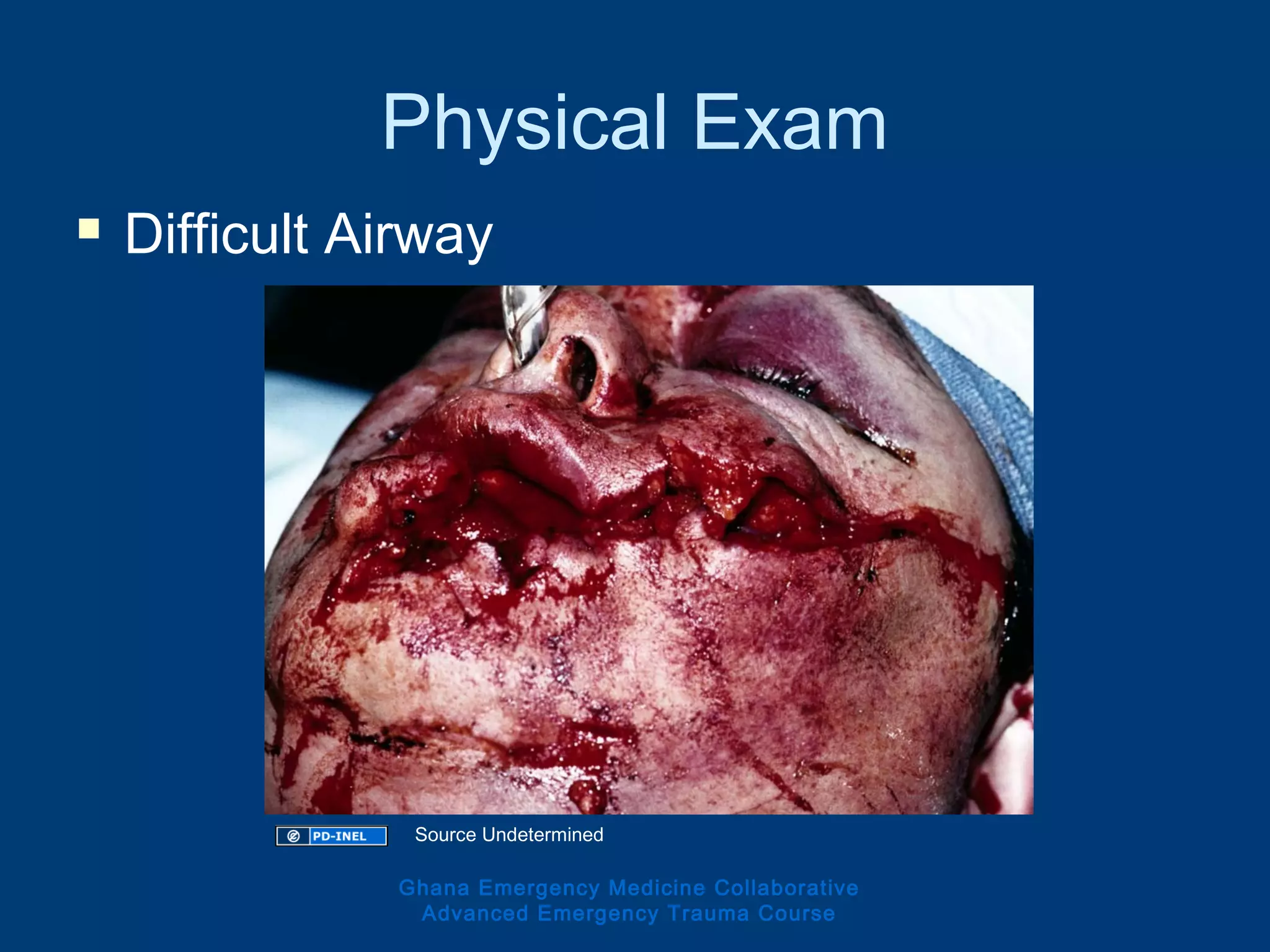 Physical Exam
 Difficult Airway
Ghana Emergency Medicine Collaborative
Advanced Emergency Trauma Course
Source Undetermined
 