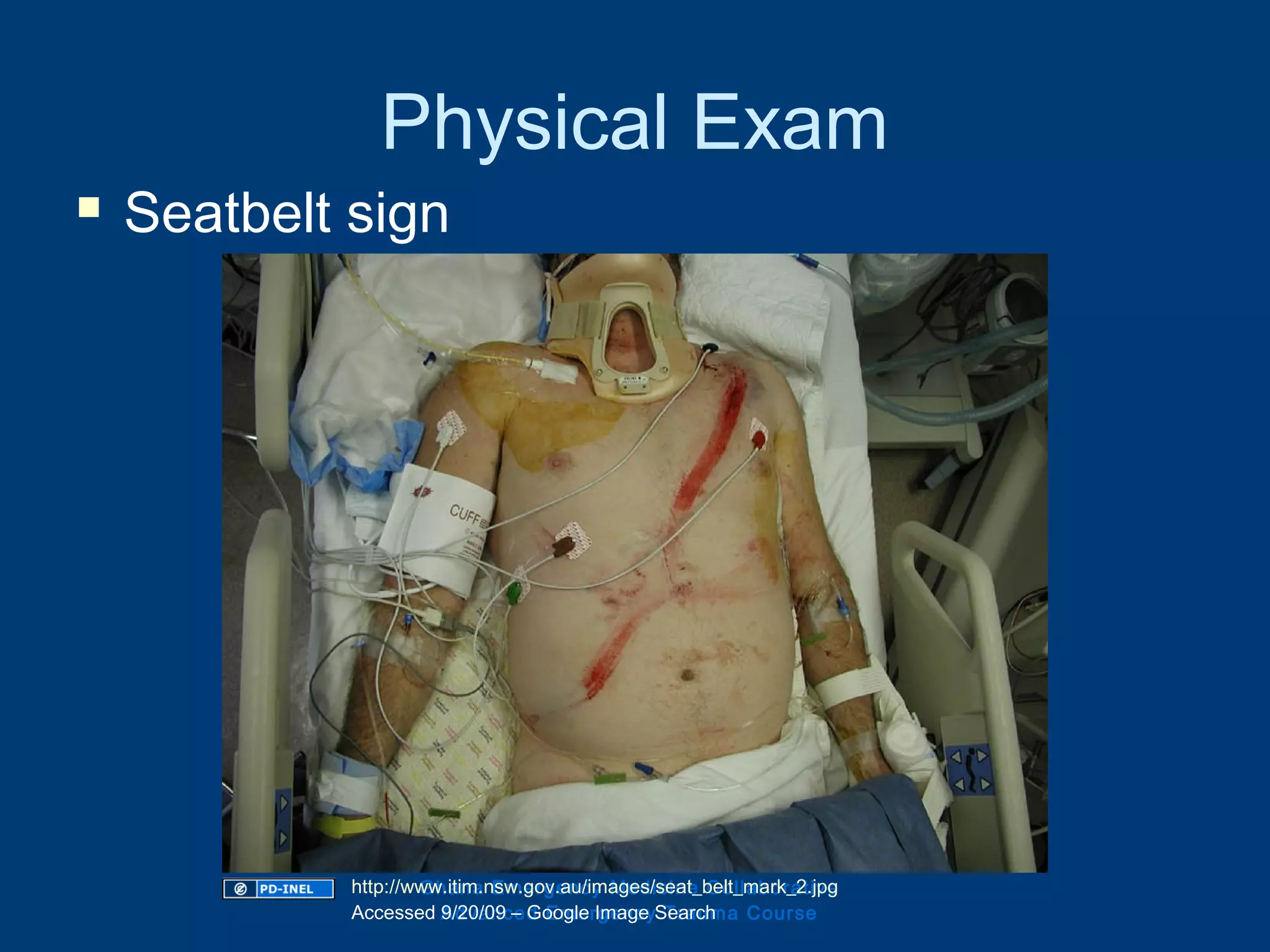 Physical Exam
 Seatbelt sign
Ghana Emergency Medicine Collaborative
Advanced Emergency Trauma Course
http://www.itim.nsw.gov.au/images/seat_belt_mark_2.jpg
Accessed 9/20/09 – Google Image Search
 