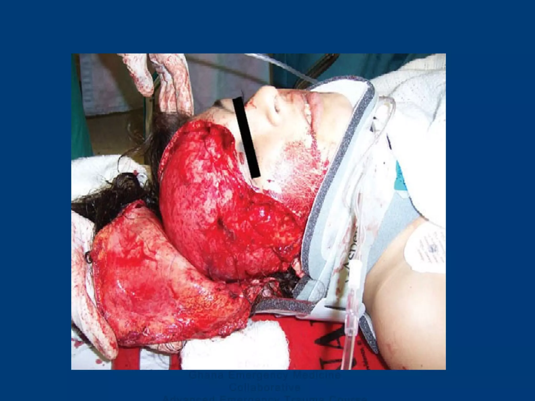 Ghana Emergency Medicine
Collaborative
 