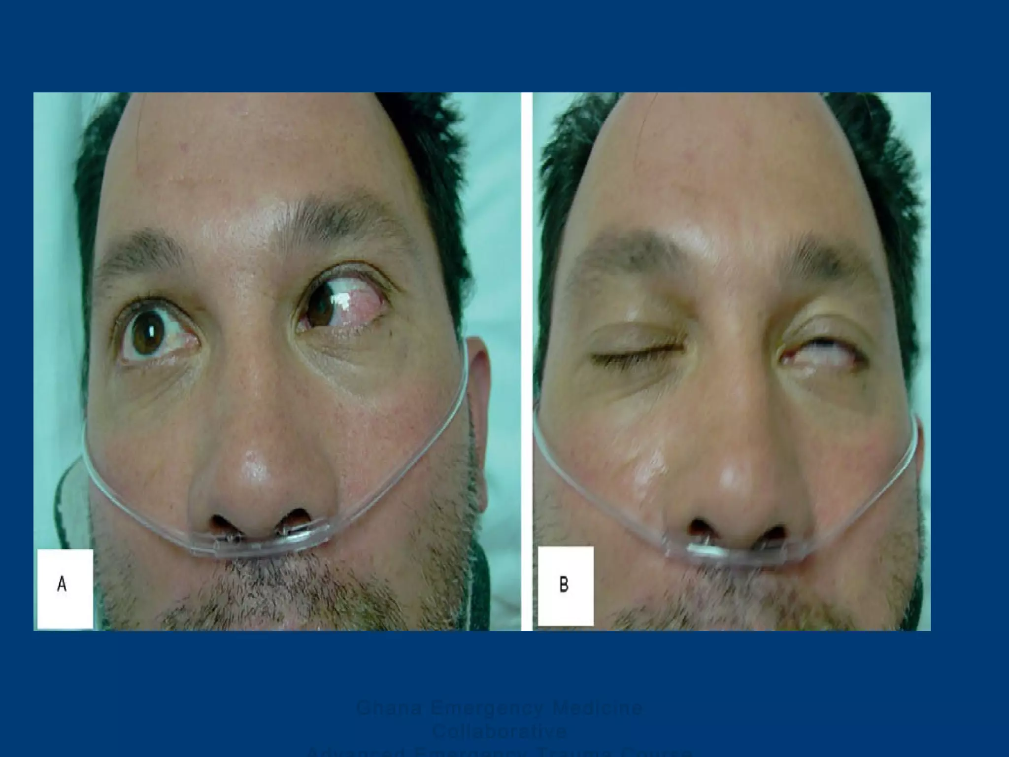 Ghana Emergency Medicine
Collaborative
 