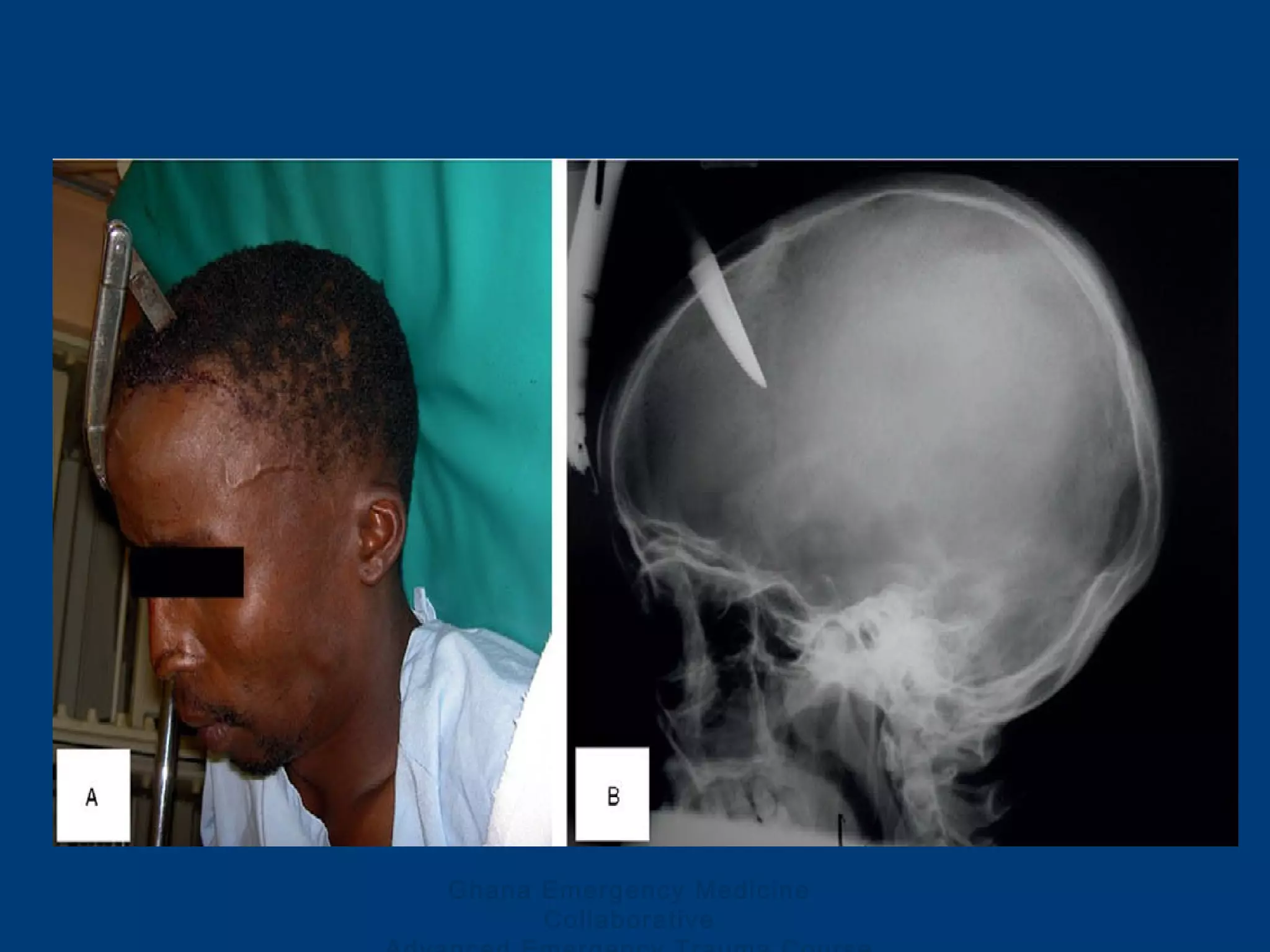 Ghana Emergency Medicine
Collaborative
 