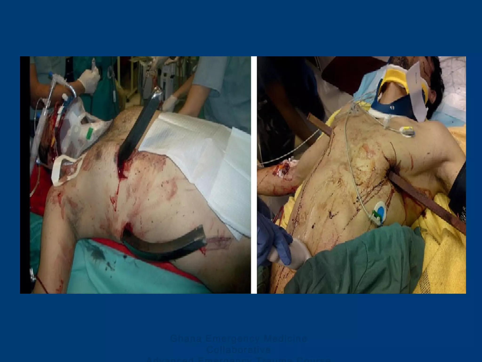 Ghana Emergency Medicine
Collaborative
 