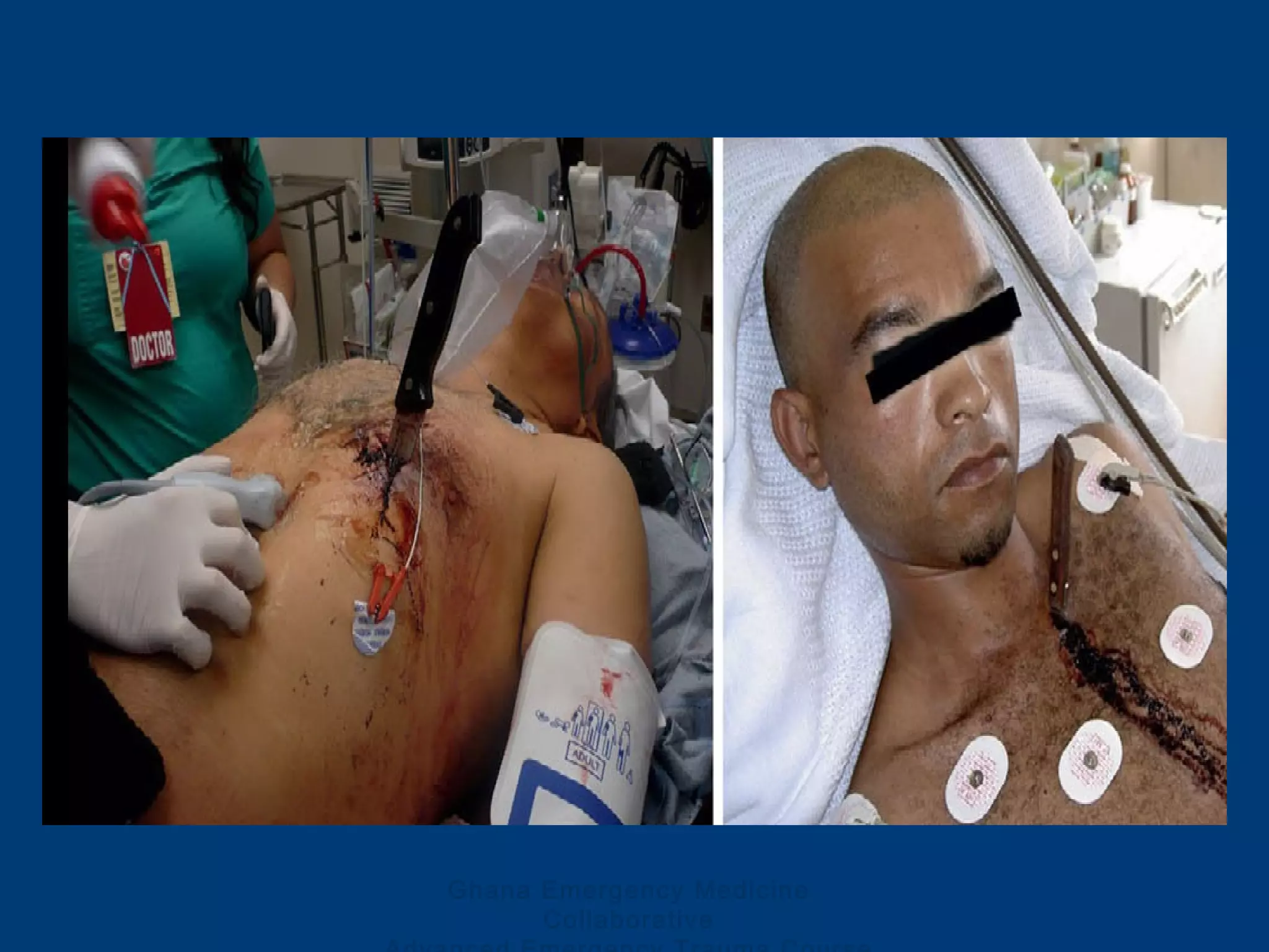 Ghana Emergency Medicine
Collaborative
 