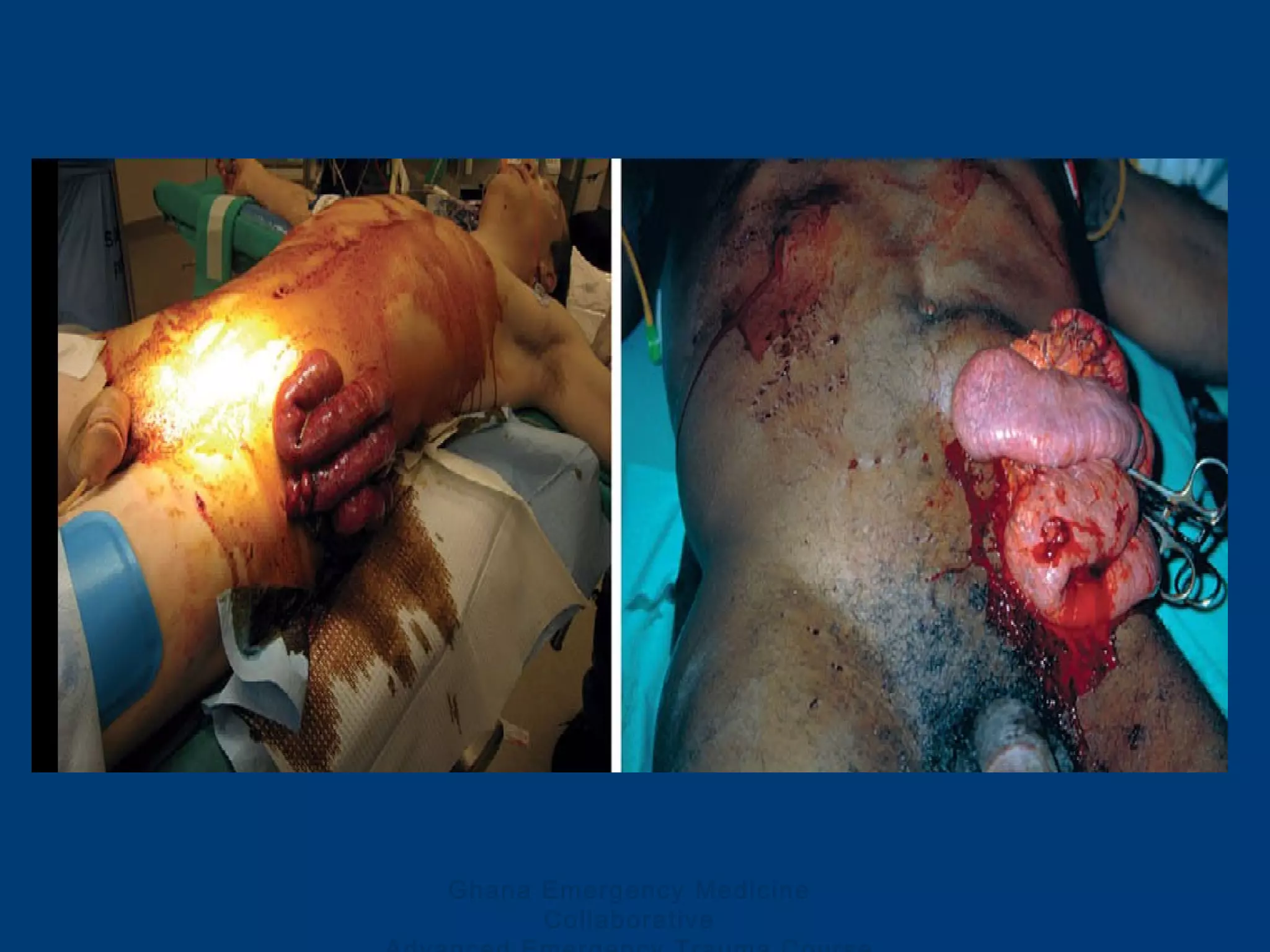 Ghana Emergency Medicine
Collaborative
 