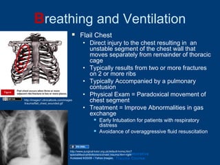 Breathing and Ventilation
 Flail Chest
• Direct injury to the chest resulting in an
unstable segment of the chest wall that
moves separately from remainder of thoracic
cage
• Typically results from two or more fractures
on 2 or more ribs
• Typically Accompanied by a pulmonary
contusion
• Physical Exam = Paradoxical movement of
chest segment
• Treatment = Improve Abnormalities in gas
exchange
 Early Intubation for patients with respiratory
distress
 Avoidance of overaggressive fluid resuscitation
Ghana Emergency Medicine Collaborative
Advanced Emergency Trauma Course
http://images1.clinicaltools.com/images
/trauma/flail_chest_wounded.gif
http://www.surgical-tutor.org.uk/default-home.htm?
specialities/cardiothoracic/chest_trauma.htm~right
Accessed 9/20/09 – Yahoo Images
 
