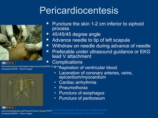 Pericardiocentesis
 Puncture the skin 1-2 cm inferior to xiphoid
process
 45/45/45 degree angle
 Advance needle to tip of left scapula
 Withdraw on needle during advance of needle
 Preferable under ultrasound guidance or EKG
lead V attachment
 Complications
• Aspiration of ventricular blood
• Laceration of coronary arteries, veins,
epicardium/myocardium
• Cardiac arrhythmia
• Pneumothorax
• Puncture of esophagus
• Puncture of peritoneum
Ghana Emergency Medicine Collaborative
Advanced Emergency Trauma Course
http://www.trauma.org/images/image_library/chest0054_thumb.jpg
Accessed 9/20/09 – Yahoo Images
www.brooksidepress.org/ProductsTrauma_Surgery?M=A
Accessed 9/20/09 – Yahoo Images
 