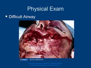 Physical Exam
 Difficult Airway
Ghana Emergency Medicine Collaborative
Advanced Emergency Trauma Course
Source Undetermined
 