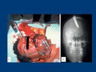 Ghana Emergency Medicine
Collaborative
 