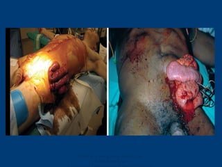 Ghana Emergency Medicine
Collaborative
 