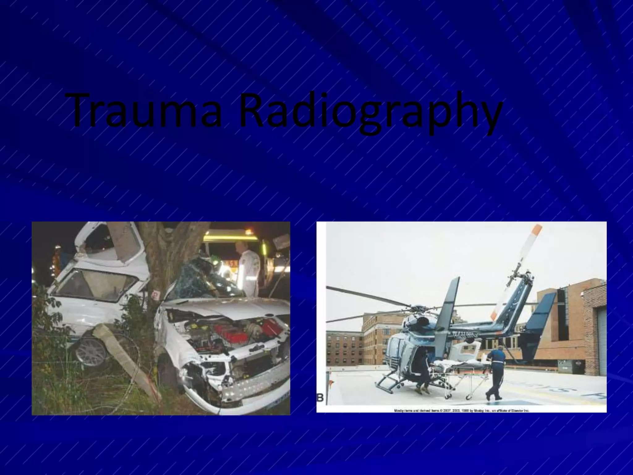 Sharp Force Trauma Radiograph Trauma radiograph | PPTX