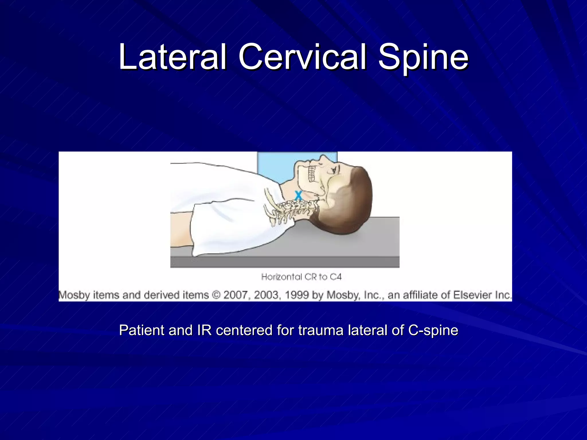 Lateral Cervical Spine Patient and IR centered for trauma lateral of C-spine 