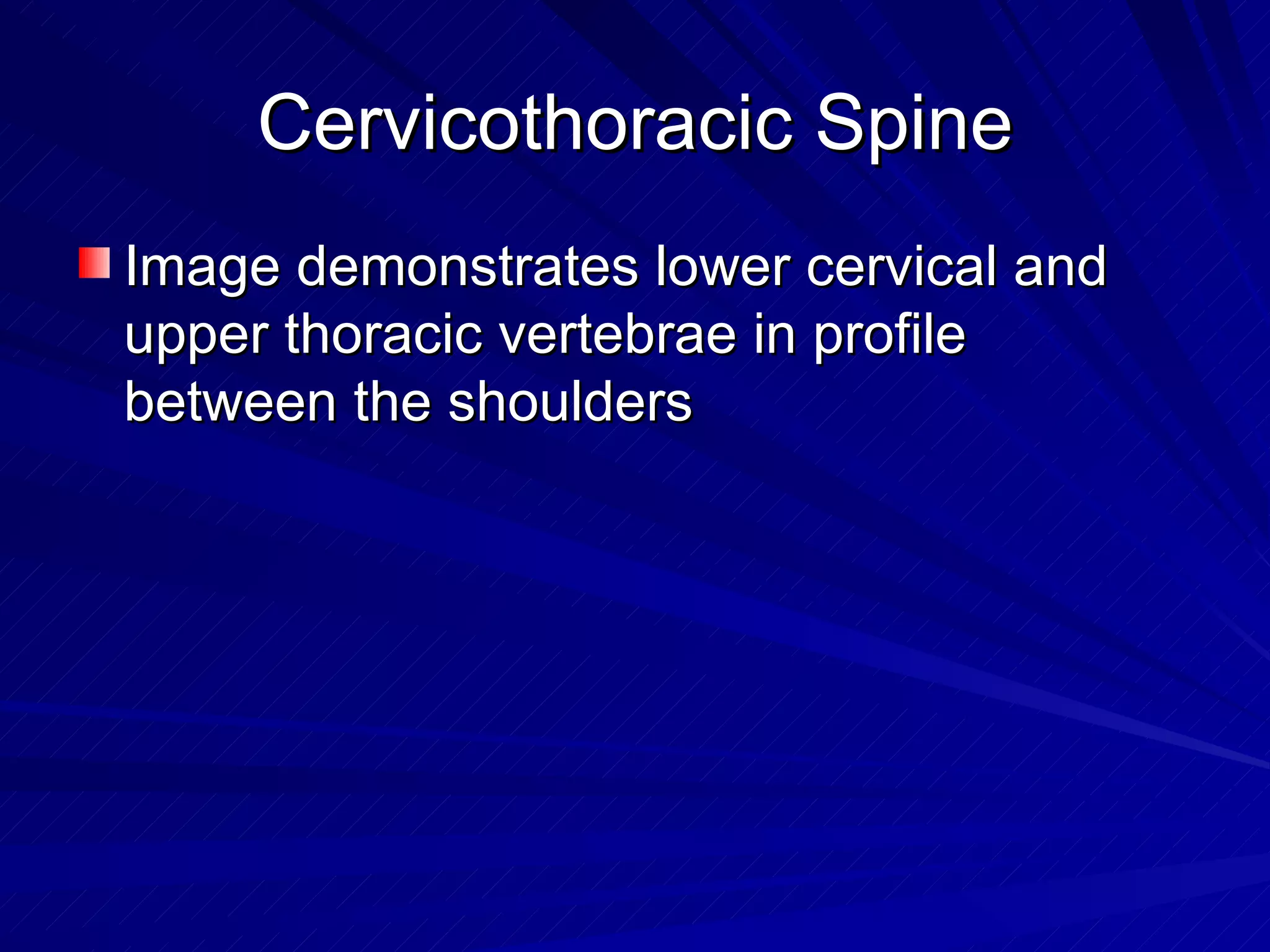 Cervicothoracic Spine Image demonstrates lower cervical and upper thoracic vertebrae in profile between the shoulders 