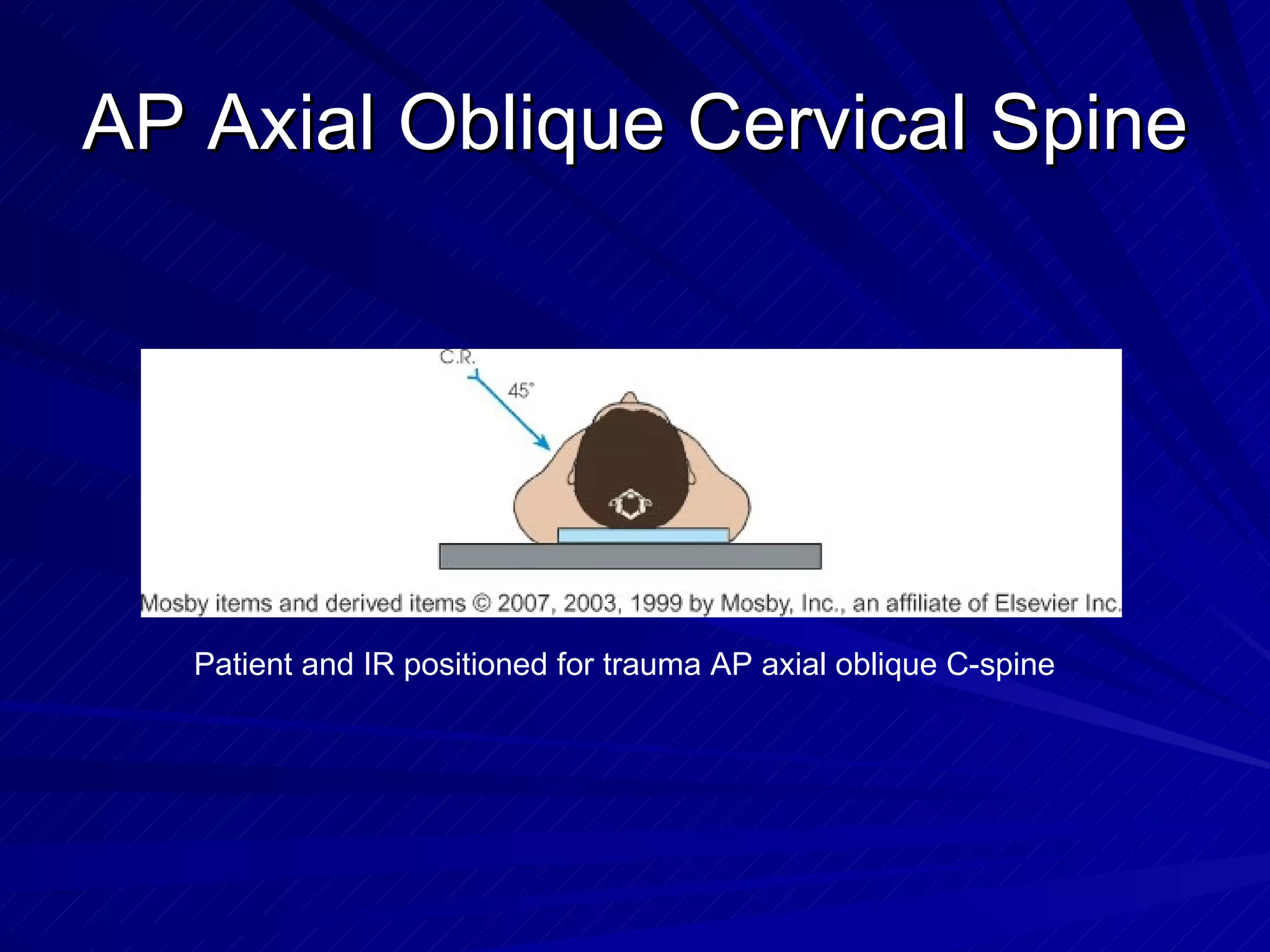 AP Axial Oblique Cervical Spine Patient and IR positioned for trauma AP axial oblique C-spine 