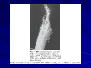 Sharp Force Trauma Radiograph Trauma Radiography | PPT