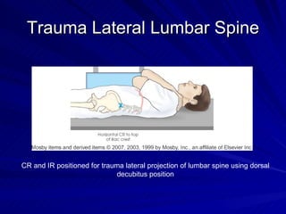 Trauma Lateral Lumbar Spine CR and IR positioned for trauma lateral projection of lumbar spine using dorsal decubitus posi...