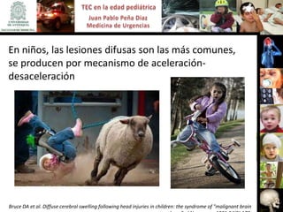 En niños, las lesiones difusas son las más comunes,
se producen por mecanismo de aceleración-
desaceleración




Bruce DA et al. Diffuse cerebral swelling following head injuries in children: the syndrome of "malignant brain
 