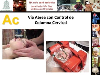 Ac   Vía Aérea con Control de
         Columna Cervical
 