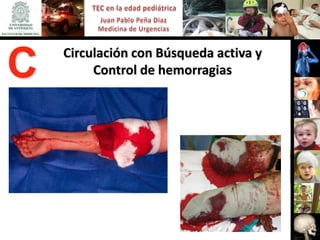 Circulación con Búsqueda activa y
C        Control de hemorragias
 
