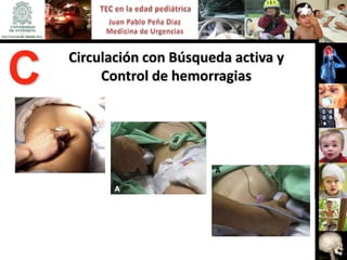Circulación con Búsqueda activa y
C        Control de hemorragias
 