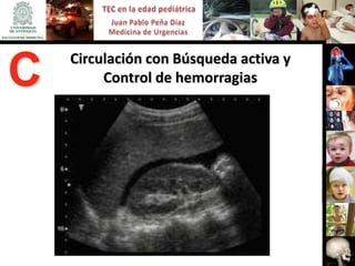 Circulación con Búsqueda activa y
C        Control de hemorragias
 