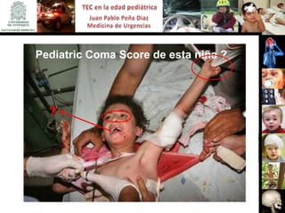 Pediatric Coma Score de esta niña ?




  ?
 