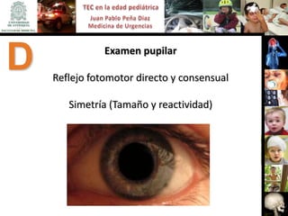 D              Examen pupilar

    Reflejo fotomotor directo y consensual

       Simetría (Tamaño y reactividad)
 