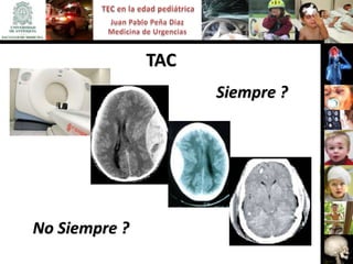 TAC
                     Siempre ?




No Siempre ?
 